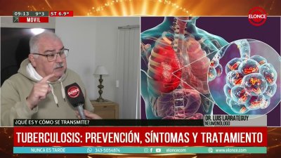 Tuberculosis: s&iacute;ntomas y alerta por el aumento de casos